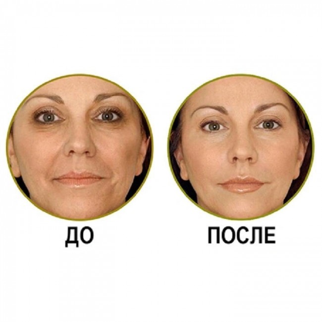 Lica Estetic "Экспресс-Омоложение" Натуральная сыворотка для мгновенного омоложения, 10*2 мл Lica Estetic "Экспресс-Омоложение" Натуральная сыворотка для мгновенного омоложения, 10*2 мл