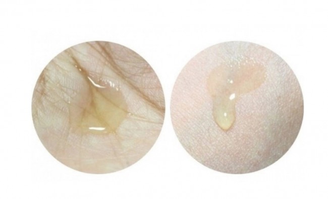 Ciracle Средство точечное от акне Anti-blemish Spot A Sol, 30 мл Ciracle Средство точечное от акне Anti-blemish Spot A Sol, 30 мл