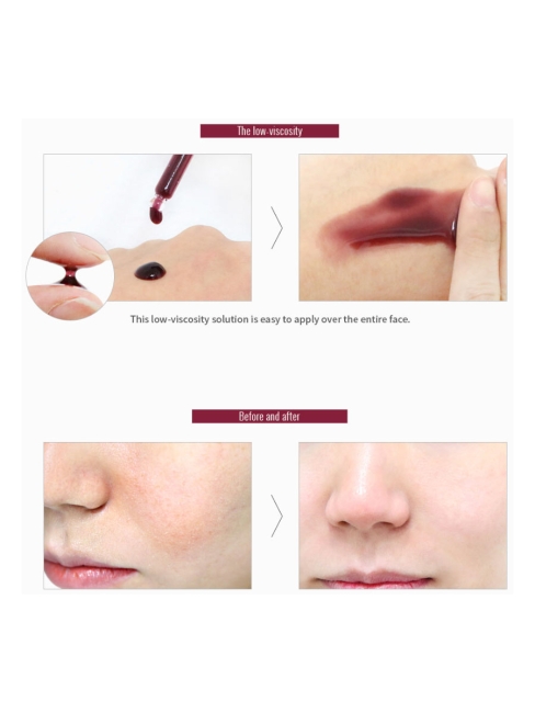 So Natural Кислотная сыворотка с тингл-эффектом Red Peel Tingle Serum, 35 мл