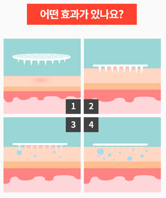 A'PIEU Madecassoside Needle Spot Patch Точечные патчи с мадекассосидом, 10 шт