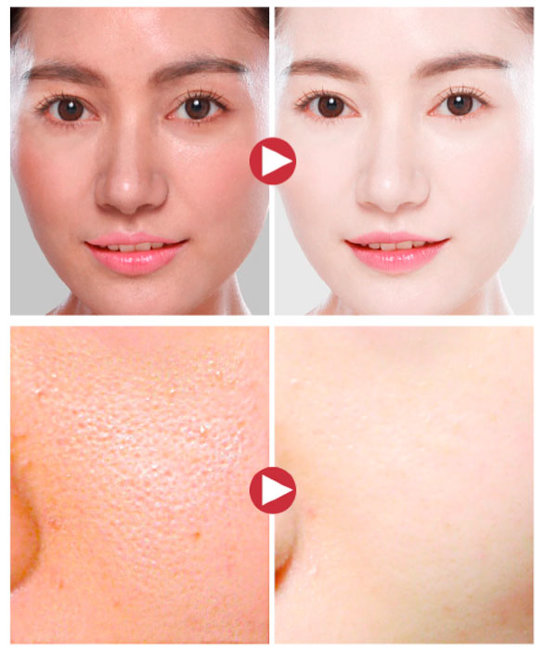 Images Skin EGF Эссенция для лица Омолаживающая, 10 мл Images Skin EGF Эссенция для лица Омолаживающая, 10 мл