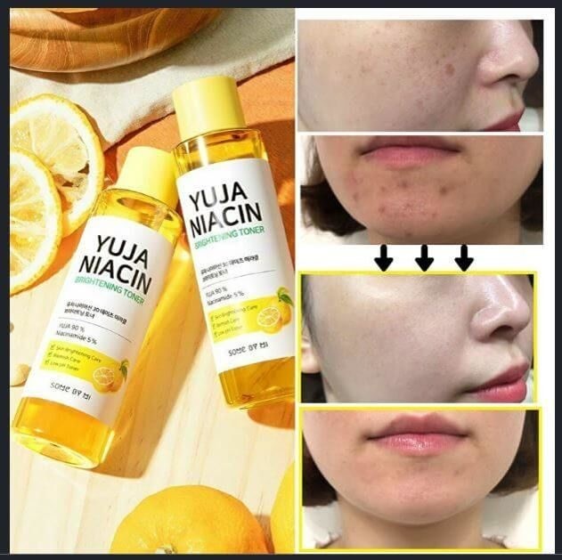 Some By Mi Тонер для лица с экстрактом юдзу для сияния кожи YUJA NIACIN BRIGHTENING TONER, 150 мл Some By Mi Тонер для лица с экстрактом юдзу для сияния кожи YUJA NIACIN BRIGHTENING TONER, 150 мл
